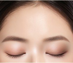 수술 후 매끈해진 이마와 눈 일러스트