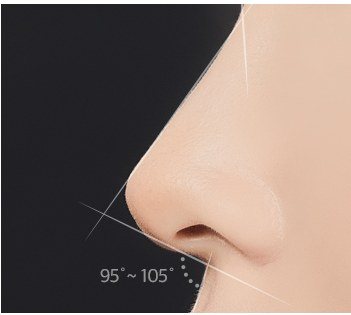 상담 및 디자인 단계 코 각도 일러스트