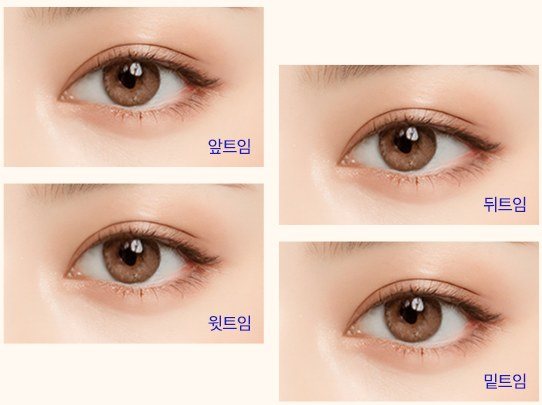 트임 부위별 눈매 사진 (앞트임, 윗트임, 뒤트임, 밑트임)