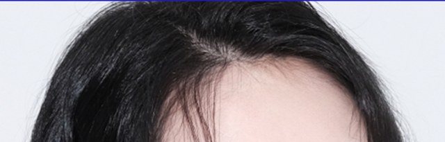 여성의 헤어라인 및 이마 윗부분 사진