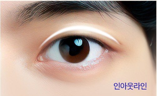 인아웃라인 쌍꺼풀 예시 눈 사진