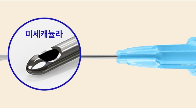 미세캐뉼라 팁 확대 및 주사 바늘 일러스트