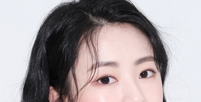 시술 전후 비교 여성 인물 사진 (우측)