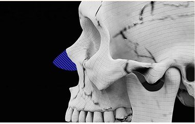 비중격연골 부위 3D 두개골 모델 사진