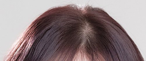 여성의 정수리와 앞머리 부분