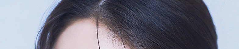 여성 이마 및 헤어라인