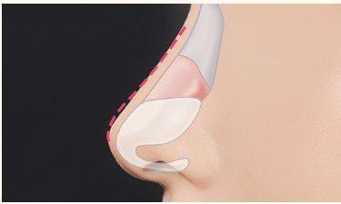 공간 확보 과정 일러스트