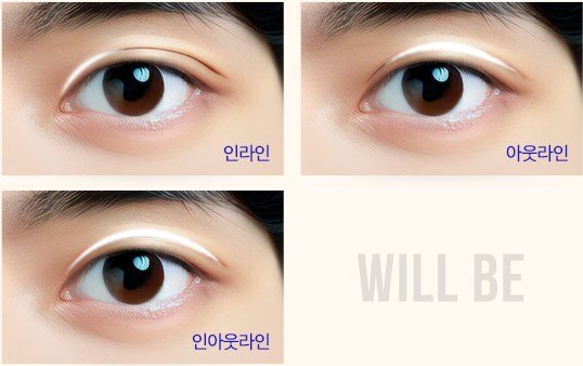 인라인, 아웃라인, 인아웃라인 쌍꺼풀 라인 비교 예시