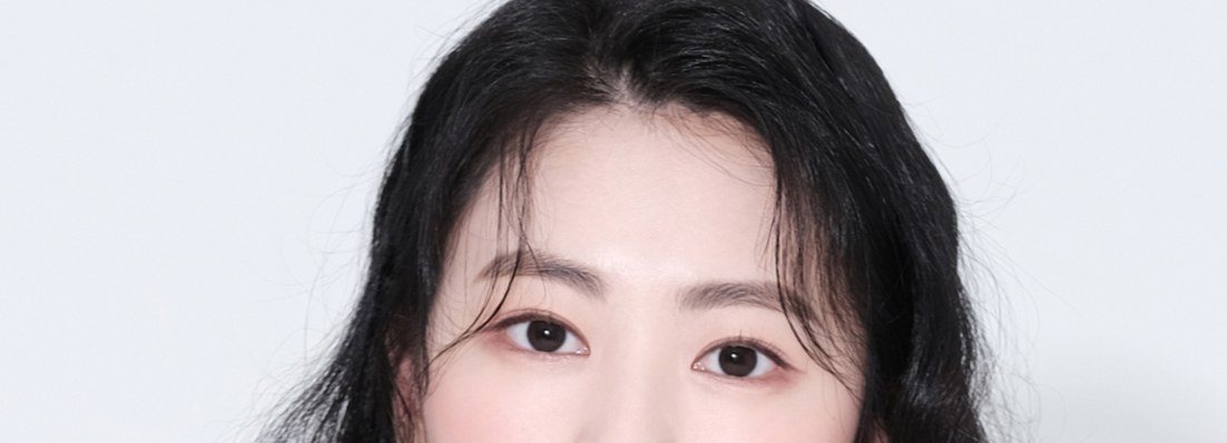 시술 전후 비교 여성 인물 사진 (좌측)