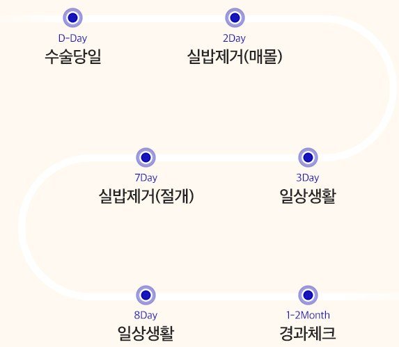 수술 후 사후관리 타임라인 (D-Day 수술당일, 2Day 실밥제거(매몰), 3Day 일상생활, 7Day 실밥제거(절개), 8Day 일상생활,