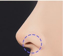 비주 및 콧구멍 절개 부위 점선 표시 일러스트